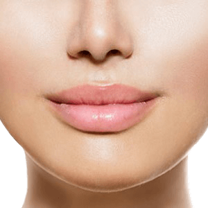 lip filler swelling stages